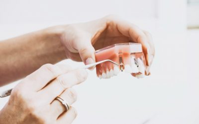 Prótesis Dental: Recuperando la Funcionalidad y Estética de tu Sonrisa